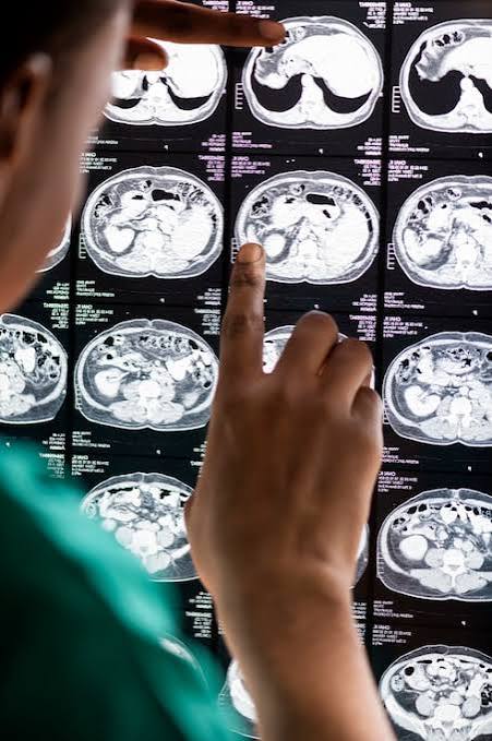CT Scan Result